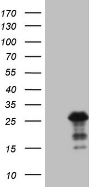 HEK293T cells were transfected with the pCMV6-ENTRY control (Left lane) or pCMV6-ENTRY BMF (Right lane) cDNA for 48 hrs and lysed