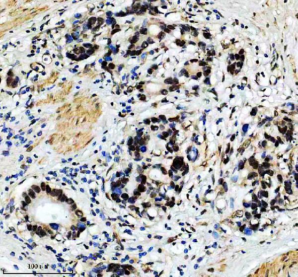 m02434 prpf19 primary antibodies ihc testing 1