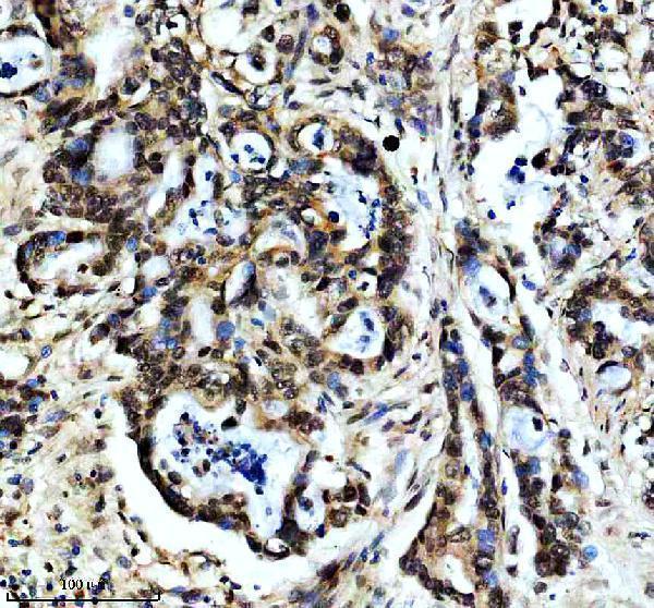 m02434 prpf19 primary antibodies ihc testing 2