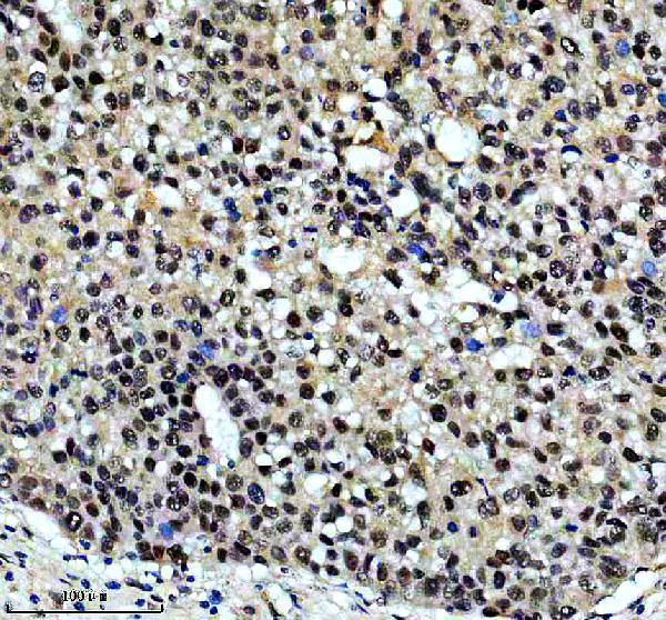 m02434 prpf19 primary antibodies ihc testing 3
