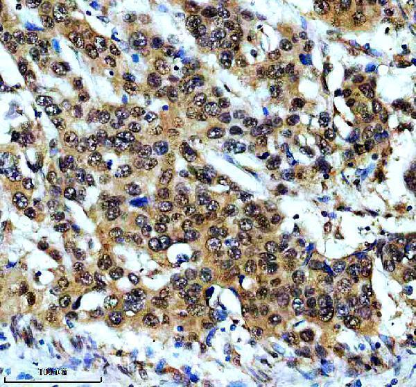 m02434 prpf19 primary antibodies ihc testing 4