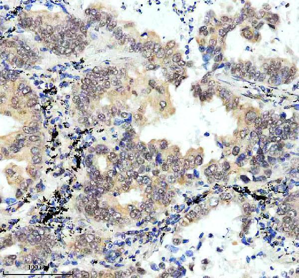m02434 prpf19 primary antibodies ihc testing 5
