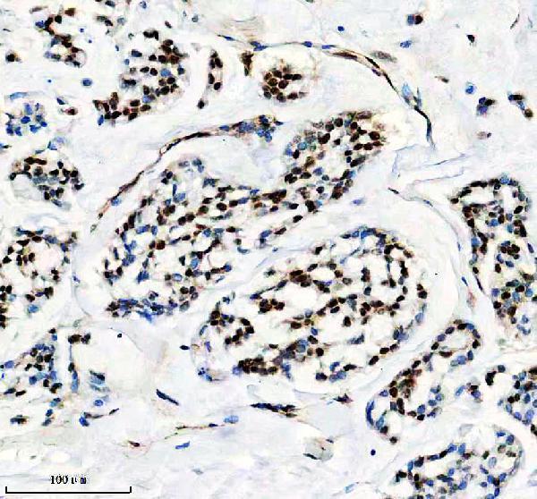m02434 prpf19 primary antibodies ihc testing 6