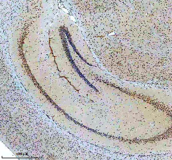m02434 prpf19 primary antibodies ihc testing 7
