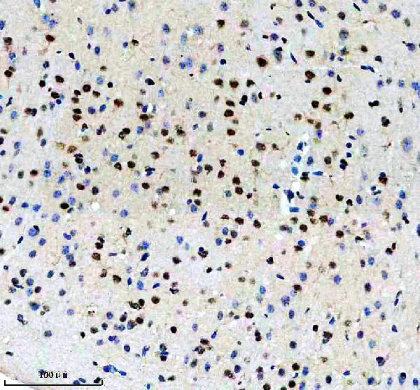 m02434 prpf19 primary antibodies ihc testing 8