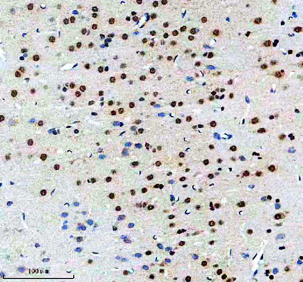 m02434 prpf19 primary antibodies ihc testing 9