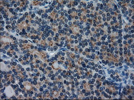 m02435 1 anti il3 mouse monoclonal antibody clone id oti3b11 ihc testing 4