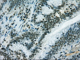 m02435 1 anti il3 mouse monoclonal antibody clone id oti3b11 ihc testing 5
