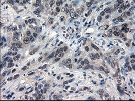 m02435 1 anti il3 mouse monoclonal antibody clone id oti3b11 ihc testing 7