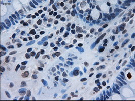 m02435 1 anti il3 mouse monoclonal antibody clone id oti3b11 ihc testing 8