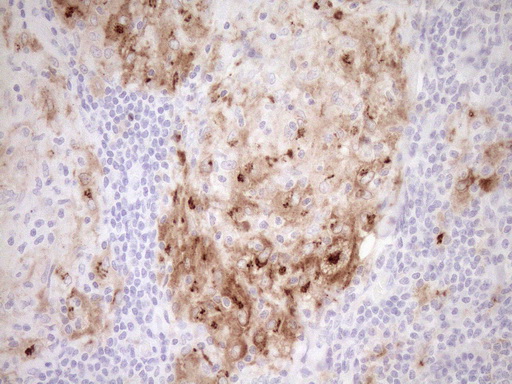 Immunohistochemical staining of paraffin-embedded Human lymph node tissue within the normal limits using anti-GPNMB mouse monoclonal antibody