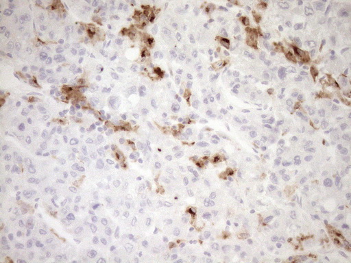 m02439 anti gpnmb mouse monoclonal antibody clone id oti2a10 ihc testing 4