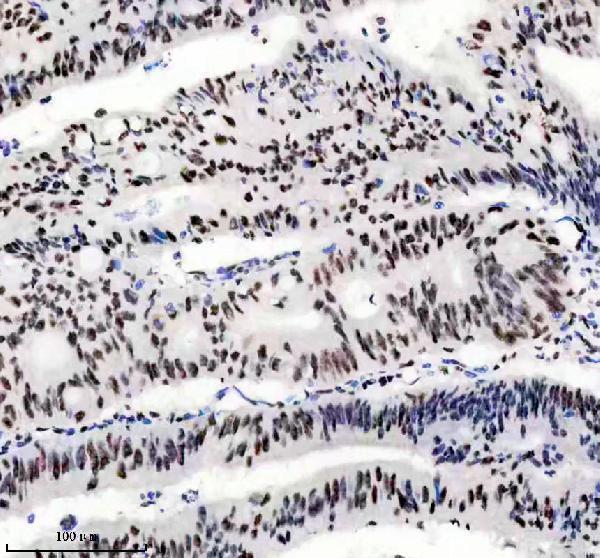 IHC analysis of PABPN1 using anti-PABPN1 antibody (M02445)