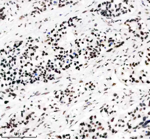 IHC analysis of PABPN1 using anti-PABPN1 antibody (M02445)