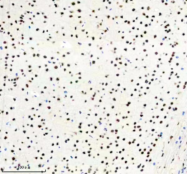 m02445 pabpn1 primary antibodies ihc testing 3
