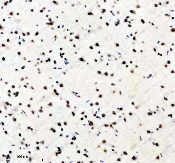 m02445 pabpn1 primary antibodies ihc testing 4