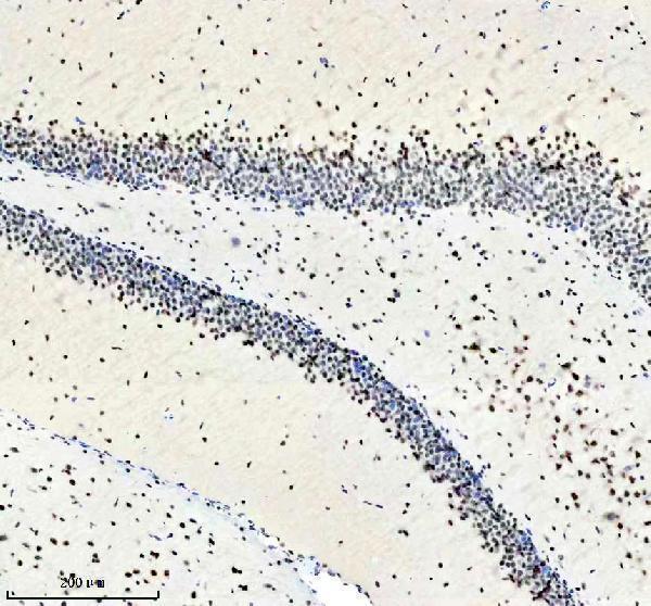 m02445 pabpn1 primary antibodies ihc testing 5