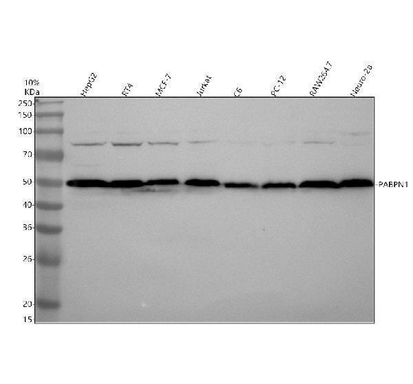 Western blot analysis of PABPN1 using anti-PABPN1 antibody (M02445)