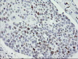 m02446 anti mafb mouse monoclonal antibody clone id oti1e9 ihc testing 10
