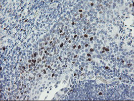 m02446 anti mafb mouse monoclonal antibody clone id oti1e9 ihc testing 12