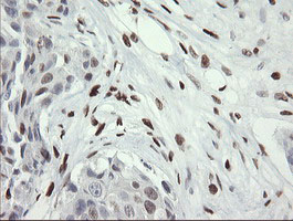 m02446 anti mafb mouse monoclonal antibody clone id oti1e9 ihc testing 13