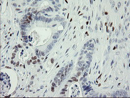 m02446 anti mafb mouse monoclonal antibody clone id oti1e9 ihc testing 14