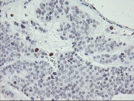 m02446 anti mafb mouse monoclonal antibody clone id oti1e9 ihc testing 6