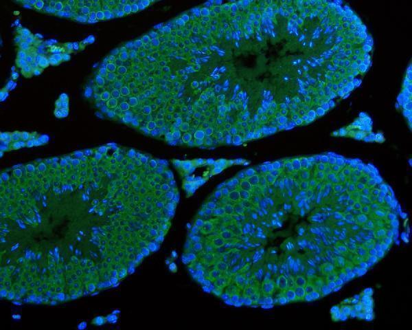 m02448 1 ddx4 primary antibodies if testing 4