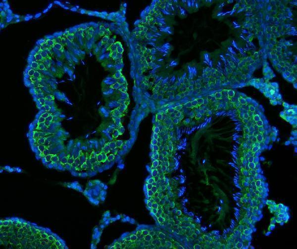 m02448 1 ddx4 primary antibodies if testing 5