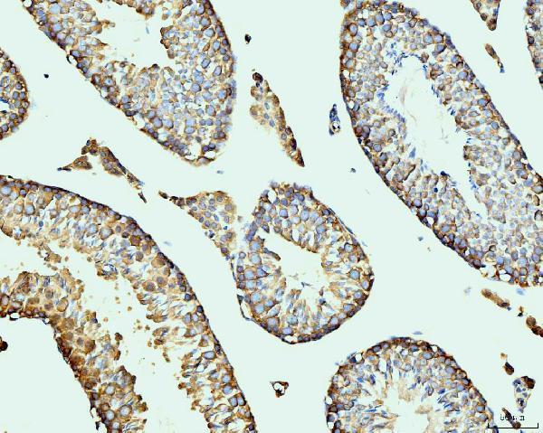  IHC analysis of DDX4/MVH using anti-DDX4/MVH antibody (M02448-1)