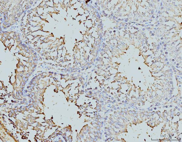  IHC analysis of DDX4/MVH using anti-DDX4/MVH antibody (M02448-1)