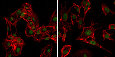 Immunofluorescence analysis of MSCs (left) and NTERA-2 (right) cells using DDX4 Monoclonal Antibody (green)