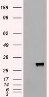 HEK293T cells were transfected with the pCMV6-ENTRY control (Left lane) or pCMV6-ENTRY APOM (Right lane) cDNA for 48 hrs and lysed