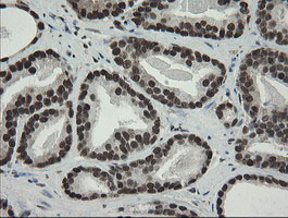 m02460 1 anti tle 1 tle1 mouse monoclonal antibody clone id oti1h2 ihc testing 11