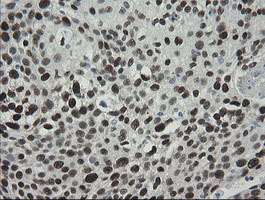 m02460 1 anti tle 1 tle1 mouse monoclonal antibody clone id oti1h2 ihc testing 12
