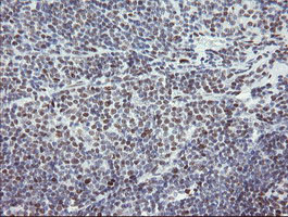 m02460 1 anti tle 1 tle1 mouse monoclonal antibody clone id oti1h2 ihc testing 13