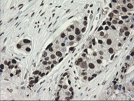 m02460 1 anti tle 1 tle1 mouse monoclonal antibody clone id oti1h2 ihc testing 15