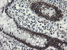 m02460 1 anti tle 1 tle1 mouse monoclonal antibody clone id oti1h2 ihc testing 16
