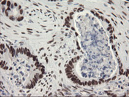 m02460 1 anti tle 1 tle1 mouse monoclonal antibody clone id oti1h2 ihc testing 17