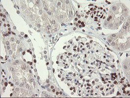 m02460 1 anti tle 1 tle1 mouse monoclonal antibody clone id oti1h2 ihc testing 18