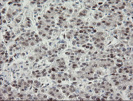 m02460 1 anti tle 1 tle1 mouse monoclonal antibody clone id oti1h2 ihc testing 20