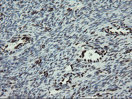 Immunohistochemical staining of paraffin-embedded Human Ovary tissue within the normal limits using anti-TLE1 mouse monoclonal antibody