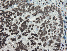 m02460 1 anti tle 1 tle1 mouse monoclonal antibody clone id oti1h2 ihc testing 4