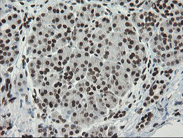 m02460 1 anti tle 1 tle1 mouse monoclonal antibody clone id oti1h2 ihc testing 5