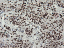 m02460 1 anti tle 1 tle1 mouse monoclonal antibody clone id oti1h2 ihc testing 6