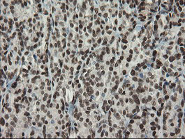 m02460 1 anti tle 1 tle1 mouse monoclonal antibody clone id oti1h2 ihc testing 7