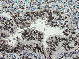 m02460 1 anti tle 1 tle1 mouse monoclonal antibody clone id oti1h2 ihc testing 8