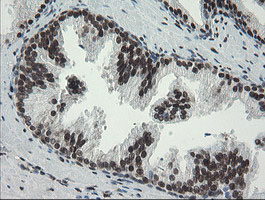 m02460 1 anti tle 1 tle1 mouse monoclonal antibody clone id oti1h2 ihc testing 9