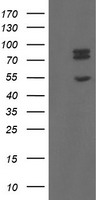 HEK293T cells were transfected with the pCMV6-ENTRY control (Left lane) or pCMV6-ENTRY TLE1 (Right lane) cDNA for 48 hrs and lysed