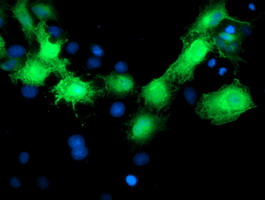 Anti-MVK mouse monoclonal antibody (M02465) immunofluorescent staining of COS7 cells transiently transfected by pCMV6-ENTRY MVK
